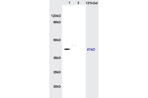 AGPAT4 anticorps  (AA 231-330)