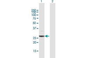 Western Blot analysis of PSMB4 expression in transfected 293T cell line by PSMB4 MaxPab polyclonal antibody. (PSMB4 antibody  (AA 1-264))