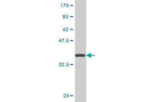 Western Blot detection against Immunogen (36. (ATG5 antibody  (AA 176-275))