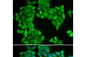 Immunofluorescence analysis of HeLa cells using SPAG5 Polyclonal Antibody (SPAG5 antibody)