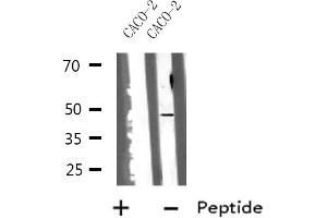 Western blot analysis of HSD17B2 using CACO-2 whole cell lysates (HSD17B2 antibody  (C-Term))