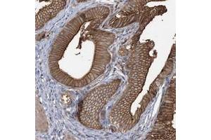 Immunohistochemical staining of human gallbladder with CCNY polyclonal antibody  shows strong cytoplasmic and membranous positivity in glandular cells at 1:50-1:200 dilution. (Cyclin Y antibody)
