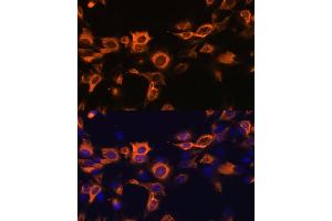 Immunofluorescence analysis of C6 cells using CSF2 antibody (ABIN6130426, ABIN6139094, ABIN6139095 and ABIN6221725) at dilution of 1:100. (GM-CSF antibody  (AA 18-144))