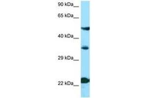 Image no. 1 for anti-Melanocortin 4 Receptor (MC4R) (N-Term) antibody (ABIN6748393) (MC4R antibody  (N-Term))