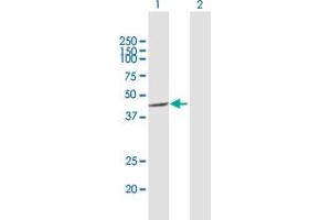 Western Blot analysis of CSNK1A1L expression in transfected 293T cell line by CSNK1A1L MaxPab polyclonal antibody. (CSNK1A1L antibody  (AA 1-337))