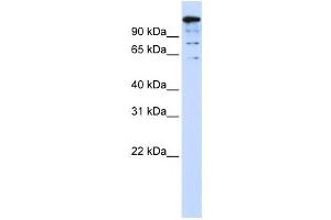Western Blotting (WB) image for anti-BTB and CNC Homology 1, Basic Leucine Zipper Transcription Factor 2 (BACH2) antibody (ABIN2458413) (BACH2 antibody)