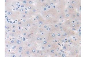 Detection of MMP3 in Human Liver Tissue using Monoclonal Antibody to Matrix Metalloproteinase 3 (MMP3) (MMP3 antibody  (AA 363-477))