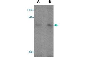 Western blot analysis of TICAM1 in human lung tissue lysates with TICAM1 polyclonal antibody  at (A) 2 and (B) 4 ug/mL . (TICAM1 antibody  (C-Term))