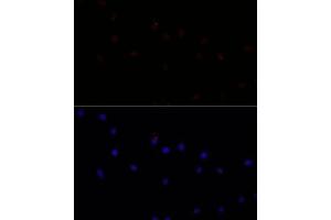Immunofluorescence analysis of L929 cells using C antibody (ABIN7266034) at dilution of 1:100. (Calpain 7 antibody  (AA 20-220))