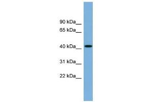 WDFY1 antibody used at 1 ug/ml to detect target protein. (WDFY1 antibody  (N-Term))