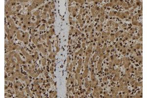 ABIN6278308 at 1/100 staining Human liver tissue by IHC-P. (IL-33 antibody  (Internal Region))