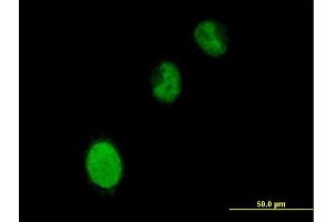 Immunofluorescence of purified MaxPab antibody to BRPF3 on HeLa cell.