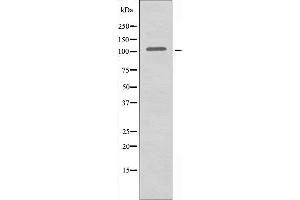 Western blot analysis of extracts from HeLa cells using AASS antibody. (AASS antibody  (C-Term))