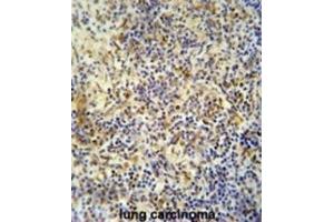 Immunohistochemistry (IHC) image for anti-KRI1 Homolog (KRI1) antibody (ABIN2995581) (KRI1 antibody)