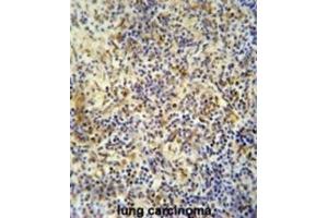 Immunohistochemistry (IHC) image for anti-KRI1 Homolog (KRI1) antibody (ABIN5015220) (KRI1 antibody)