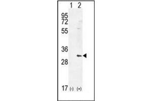 Western blot analysis of HMOX1 (arrow) using Heme oxygenase 1 / HMOX1 Antibody (Center) Cat. (HMOX1 antibody  (Middle Region))