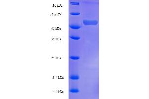 SDS-PAGE (SDS) image for Ferredoxin Reductase (FDXR) (AA 33-451) protein (His-SUMO Tag) (ABIN5709511)