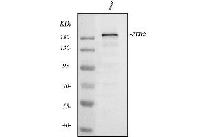 Western blot analysis of ZEB2 using anti-ZEB2 antibody (ABIN3042325). (ZEB2 antibody  (AA 1-200))