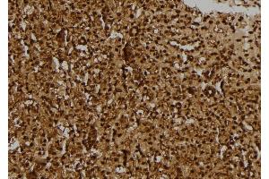 ABIN6275163 at 1/100 staining Rat kidney tissue by IHC-P. (GIDRP88 antibody  (C-Term))