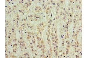 Immunohistochemistry of paraffin-embedded human adrenal gland tissue using ABIN7157726 at dilution of 1:100 (KLF3 antibody  (AA 1-240))