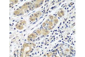 Immunohistochemistry of paraffin-embedded Human stomach using GPRC5A Polyclonal Antibody at dilution of 1:100 (40x lens). (GPRC5A antibody)