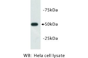 Image no. 1 for anti-Tubulin, beta 3 (TUBB3) antibody (ABIN1112834) (TUBB3 antibody)