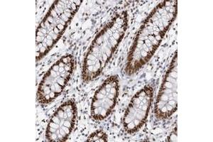 Immunohistochemical staining of human colon with IRF2BP2 polyclonal antibody  shows strong nuclear positivity in glandular cells at 1:1000-1:2500 dilution. (IRF2BP2 antibody)
