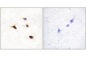 Immunohistochemistry analysis of paraffin-embedded human brain tissue, using IP6K3 Antibody. (IP6K3 antibody  (AA 201-250))