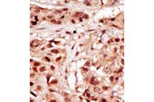 Image no. 2 for anti-TP53 Regulating Kinase (TP53RK) (Middle Region) antibody (ABIN360571) (TP53RK antibody  (Middle Region))