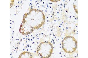 Immunohistochemistry of paraffin-embedded Human stomach using CAMK1 Polyclonal Antibody at dilution of 1:100 (40x lens). (CAMK1 antibody)