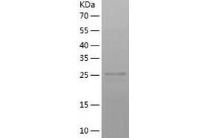 CLIC4 Protein (AA 1-253) (His tag)