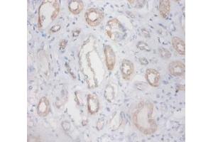 Immunohistochemistry of paraffin-embedded human kidney using ZNF91 antibody at dilution 1:100. (ZFP91 antibody  (HRP))