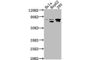 Western Blot Positive WB detected in: Hela whole cell lysate, HepG2 whole cell lysate, 293 whole cell lysate All lanes: SRPK2 antibody at 1:1000 Secondary Goat polyclonal to rabbit IgG at 1/50000 dilution Predicted band size: 78, 80 kDa Observed band size: 78 kDa (SRPK2 antibody  (AA 471-688))
