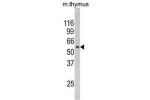 Image no. 1 for anti-Regulator of Chromosome Condensation (RCC1) and BTB (POZ) Domain Containing Protein 2 (RCBTB2) (N-Term) antibody (ABIN452843) (RCBTB2 antibody  (N-Term))