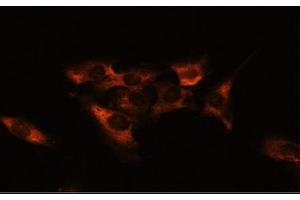 Immunofluorescence analysis of C6 cells using ADORA2A Polyclonal Antibody at dilution of 1:100. (Adenosine A2a Receptor antibody)