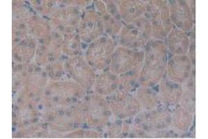 IHC-P analysis of Rat Kidney Tissue, with DAB staining. (Growth Hormone Receptor antibody  (AA 353-588))