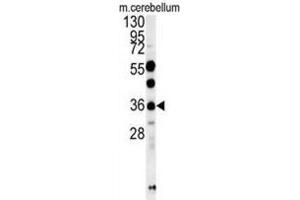 Western Blotting (WB) image for anti-OTU Domain Containing 6B (OTUD6B) antibody (ABIN3002448) (OTUD6B antibody)