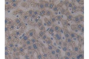 Immunohistochemistry (IHC) image for anti-Paxillin (PXN) (AA 327-568) antibody (ABIN7442531)