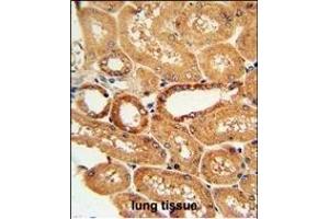 COQ9 Antibody (Center) (ABIN651084 and ABIN2840064) immunohistochemistry analysis in formalin fixed and paraffin embedded human lung tissue followed by peroxidase conjugation of the secondary antibody and DAB staining.