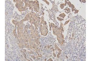IHC analysis of RNF123 using anti-RNF123 antibody (ABIN6719387). (RNF123 antibody  (AA 12-188))