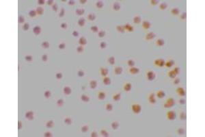 Immunocytochemistry staining of MOLT4 cells using AP30302PU-N DRAK1 antibody at 2 μg/ml. (STK17A antibody  (N-Term))