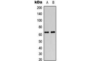 Western blot analysis of DGK epsilon expression in HeLa (A), HEK293T (B) whole cell lysates.