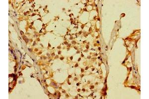 Immunohistochemistry of paraffin-embedded human testis tissue using ABIN7150619 at dilution of 1: 100 (DUX4 antibody  (AA 217-402))