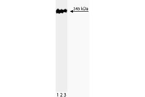 Western blot analysis of 53BP1 on a HeLa lysate. (TP53BP1 antibody  (AA 149-259))