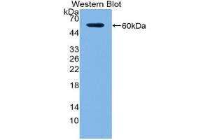 Western blot analysis of the recombinant protein. (ACP5 antibody  (AA 79-318))