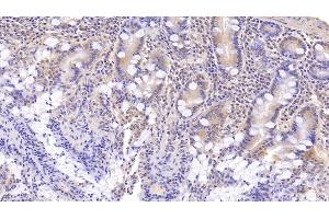 Detection of DNAH11 in Human Small intestine Tissue using Monoclonal Antibody to Dynein, Axonemal, Heavy Chain 11 (DNAH11) (DNAH11 antibody  (AA 3896-4122))