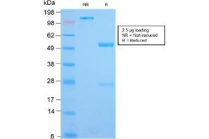 SDS-PAGE Analysis Purified IL3RA Rabbit Recombinant Monoclonal Antibody (IL3RA/2947R). (Recombinant IL3RA antibody  (AA 26-171))