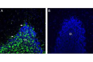 Expression of Neuroligin-3 in rat cerebellum. (Neuroligin 3 antibody  (Extracellular, N-Term))