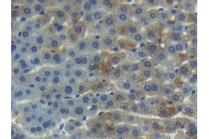 IHC-P analysis of Mouse Liver Tissue, with DAB staining. (ANG antibody  (AA 25-145))