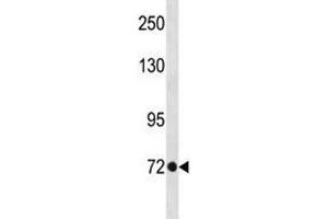 TBR2 antibody western blot analysis in A375 lysate. (EOMES antibody  (AA 28-57))